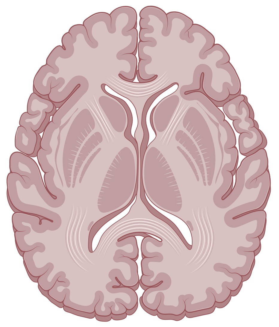 Axial brain slice showing target locations